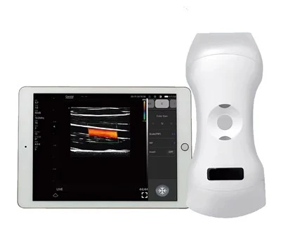 Mini Magna tal-Ultrasound li tinżamm fl-idejn